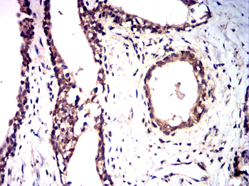 TRPM2 Antibody