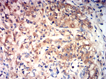 TRPM2 Antibody