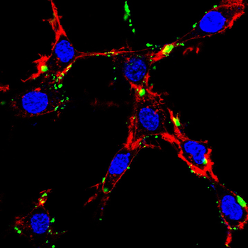 AQP2 Antibody