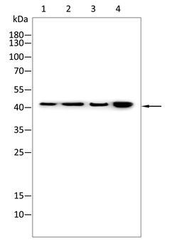 AQP2 Antibody