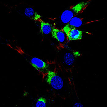 AQP4 Antibody