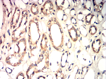 AQP6 Antibody