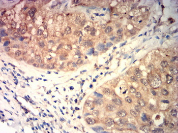AQP6 Antibody