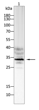 AQP6 Antibody