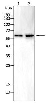 AQP7 Antibody