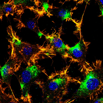 AQP11 Antibody