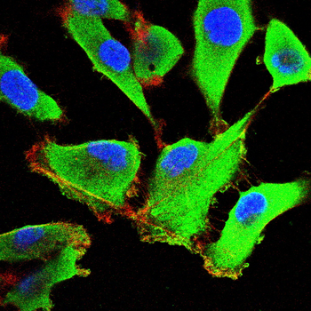 AQP10 Antibody