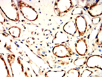 AQP10 Antibody