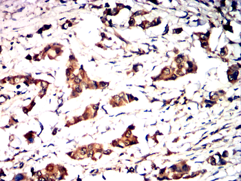 BAK1 Antibody