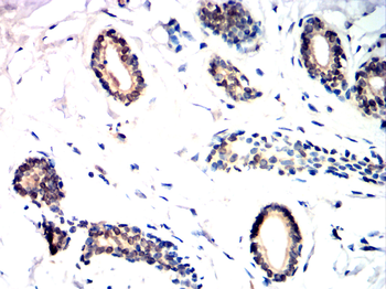 BAK1 Antibody
