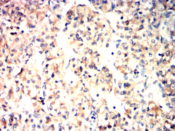 BAK1 Antibody