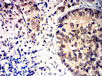 HDAC1 Antibody