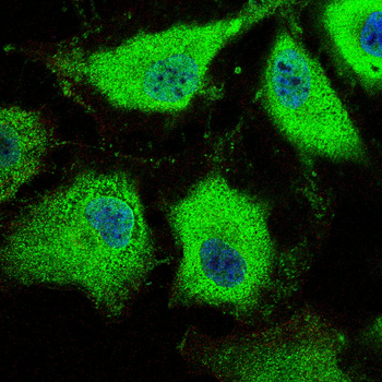 TGFB3 Antibody