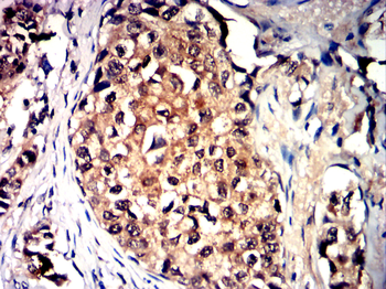 TGFB3 Antibody