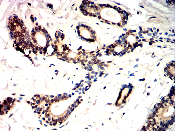 TGFB3 Antibody