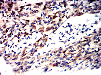 TGFB3 Antibody