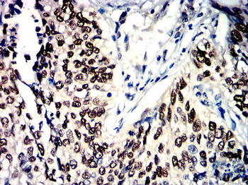 TGFB3 Antibody