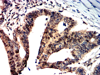 TGFB3 Antibody