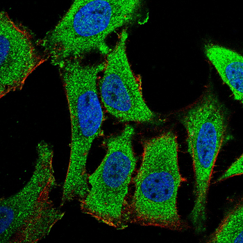 PFKFB2 Antibody
