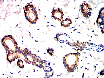 PFKFB2 Antibody