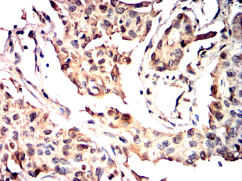 PFKFB2 Antibody