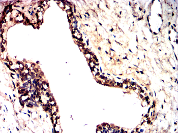 PFKFB2 Antibody
