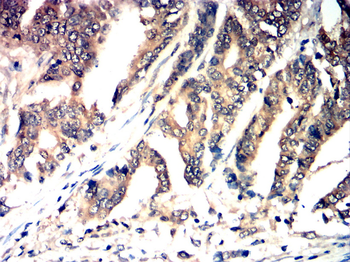 PFKFB2 Antibody
