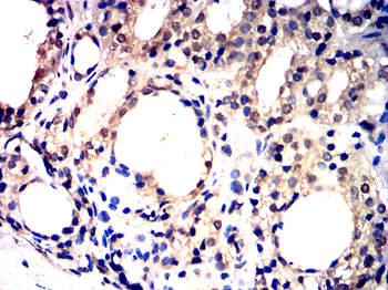 PFKFB2 Antibody