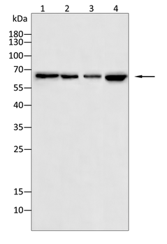 PFKFB2 Antibody