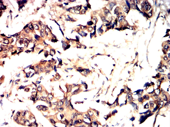 JAK3 Antibody