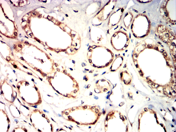 JAK3 Antibody