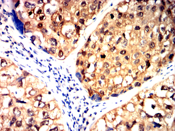 JAK3 Antibody