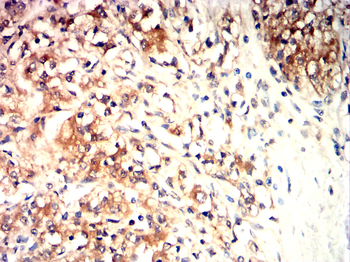 JAK3 Antibody