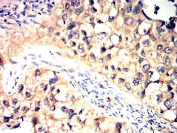 Catenin alpha-1 Antibody