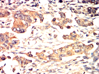 Catenin alpha-1 Antibody