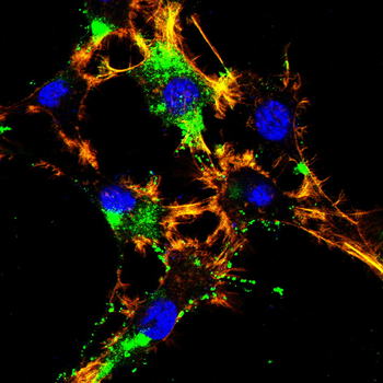 GAD1 Antibody
