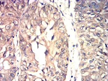 GAD1 Antibody
