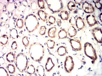 GAD1 Antibody