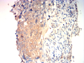 GAD1 Antibody