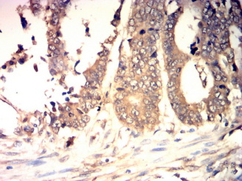 GAD1 Antibody