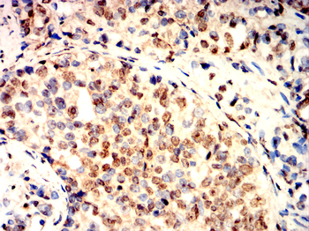 XRCC6 Antibody