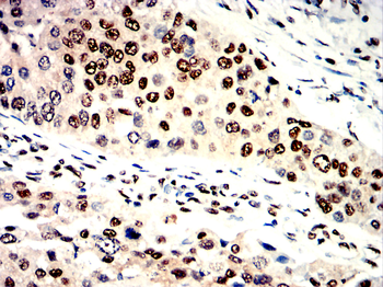 XRCC6 Antibody