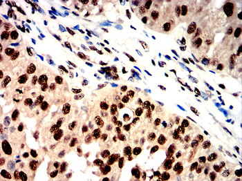 XRCC6 Antibody