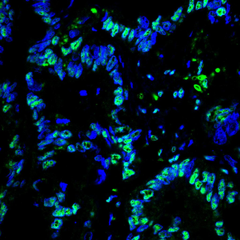 XRCC6 Antibody
