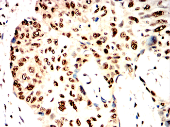 XRCC6 Antibody