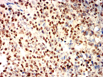XRCC6 Antibody