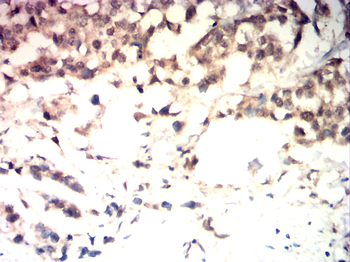 CDKN2B Antibody