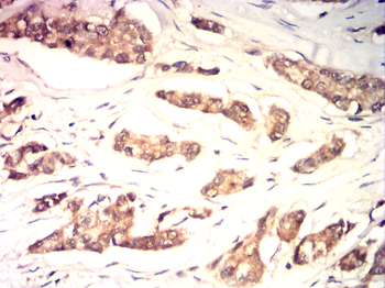 CDKN2B Antibody