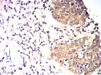 CDKN2B Antibody