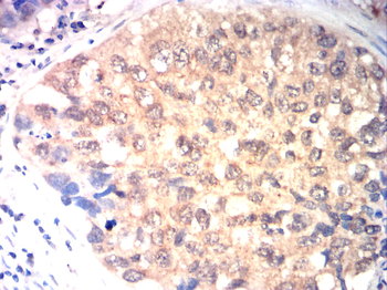 CDKN2B Antibody